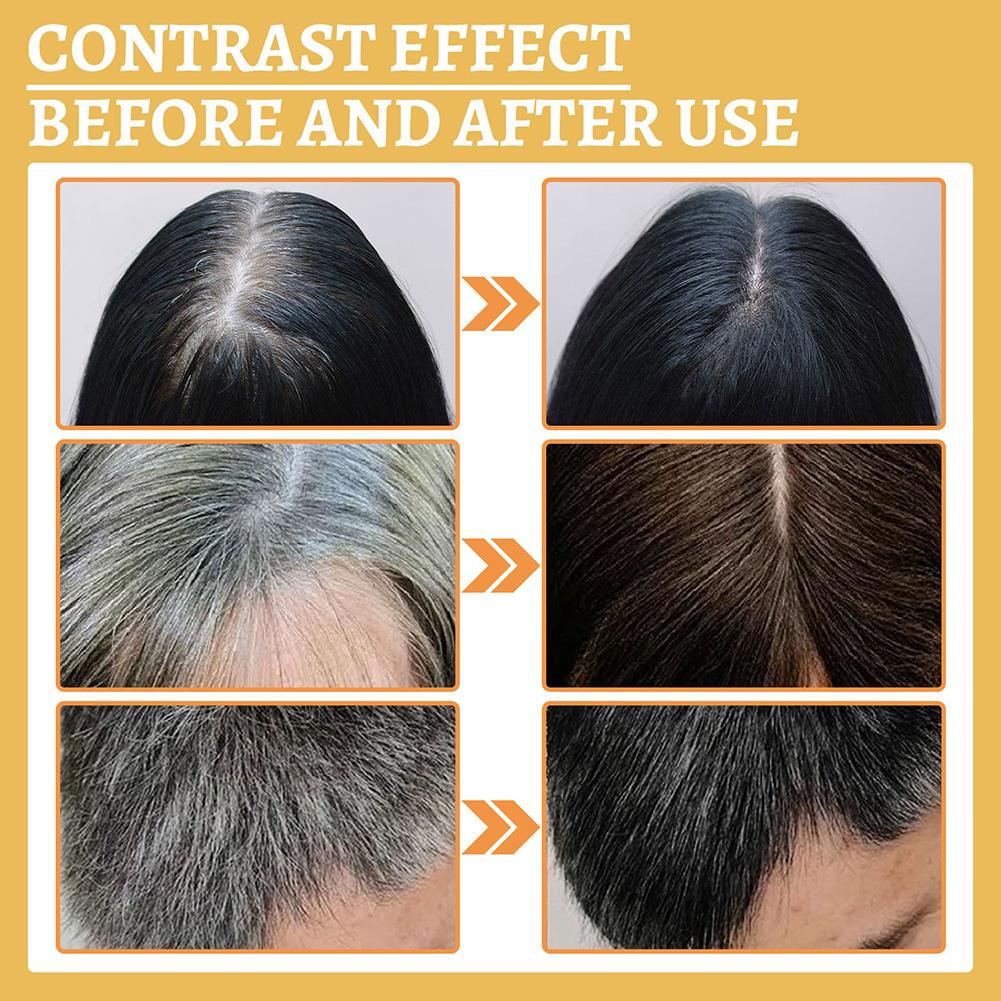 1/2PCS Hair Growth Serum Oil,  - Growth Factor Serum recension och pris