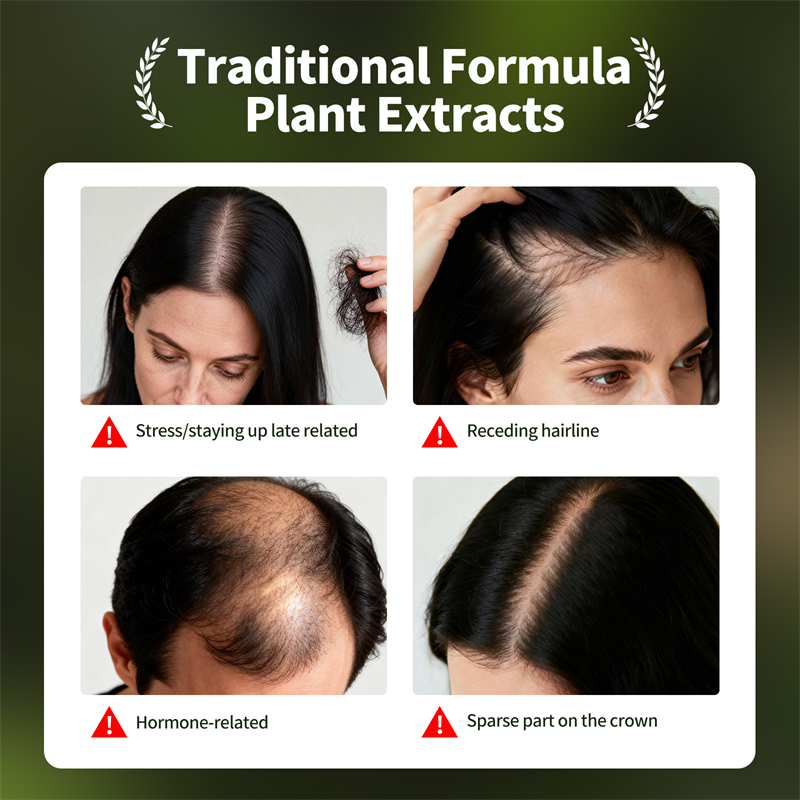 Natural Hair Growth Set Usman  - Growth Factor Serum recension och pris