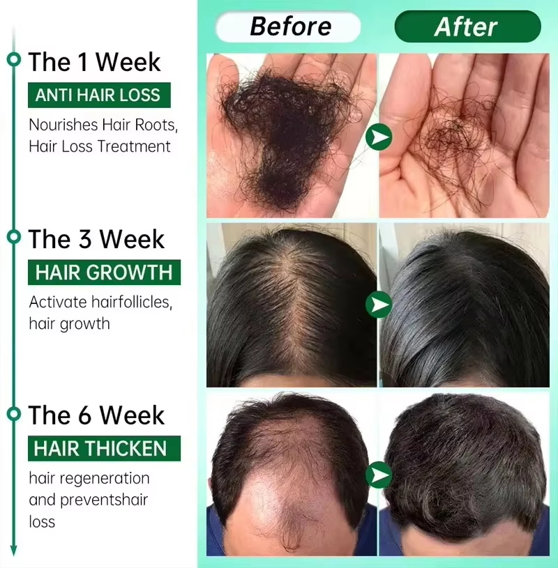 Hair Growth Serum 7 Days Fast  - Growth Factor Serum recension och pris