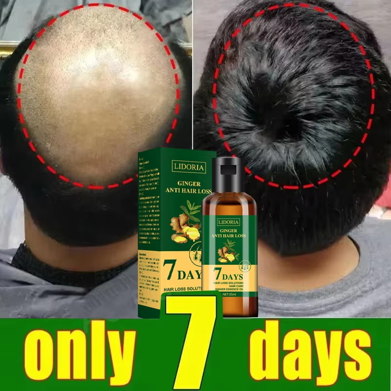 Hair Growth Serum 7 Days Fast  - Growth Factor Serum recension och pris