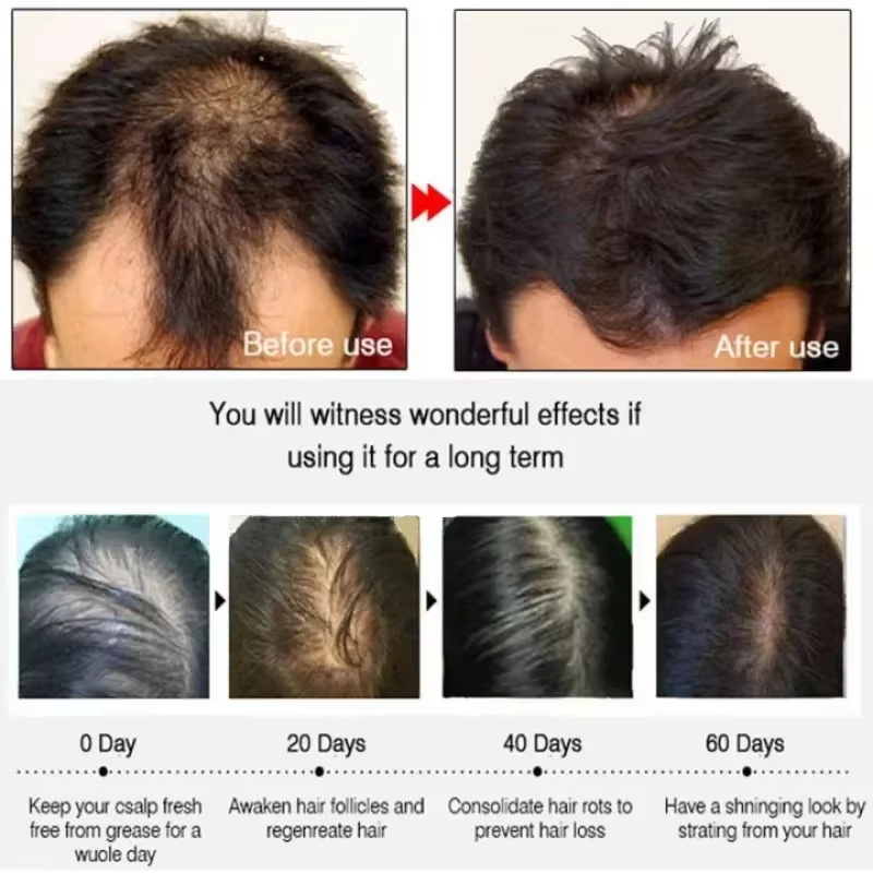 Hair Growth Serum 7 Days Fast  - Growth Factor Serum recension och pris